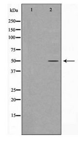 KRT16 / CK16 / Cytokeratin 16 Antibody - Western blot of Keratin 16 expression in HepG2 cell extract