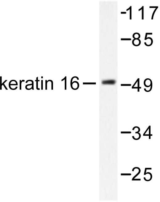 KRT16 / CK16 / Cytokeratin 16 Antibody - Western blot of Cytokeratin 16 (S451) pAb in extracts from HepG2 cells.