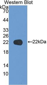 KRT17 / CK17 / Cytokeratin 17 Antibody