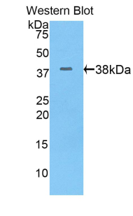 KRT17 / CK17 / Cytokeratin 17 Antibody - Western blot of recombinant KRT17 / Cytokeratin 17.  This image was taken for the unconjugated form of this product. Other forms have not been tested.