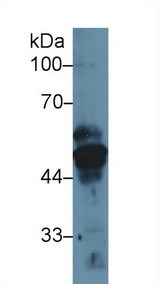 KRT17 / CK17 / Cytokeratin 17 Antibody - Western Blot; Sample: Human MCF7 cell lysate; Primary Ab: 1µg/ml Rabbit Anti-Rat KRT17 Antibody Second Ab: 0.2µg/mL HRP-Linked Caprine Anti-Rabbit IgG Polyclonal Antibody