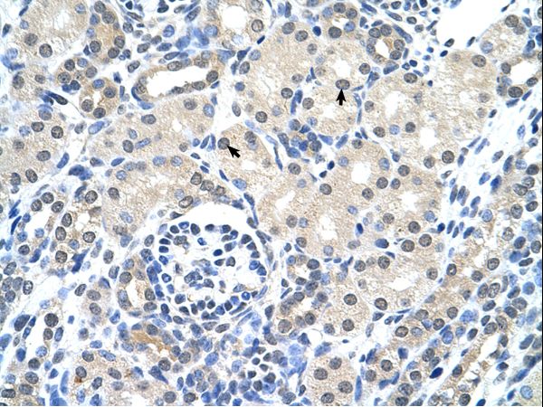KRT17 / CK17 / Cytokeratin 17 Antibody - KRT17 / Cytokeratin 17 antibody ARP41733_P050-NP_000413-KRT17(keratin 17) Antibody was used in IHC to stain formalin-fixed, paraffin-embedded human kidney.  This image was taken for the unconjugated form of this product. Other forms have not been tested.