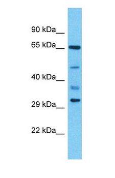 KRT17 / CK17 / Cytokeratin 17 Antibody - Western blot of KRT17 Antibody with human 721_B Whole Cell lysate.  This image was taken for the unconjugated form of this product. Other forms have not been tested.