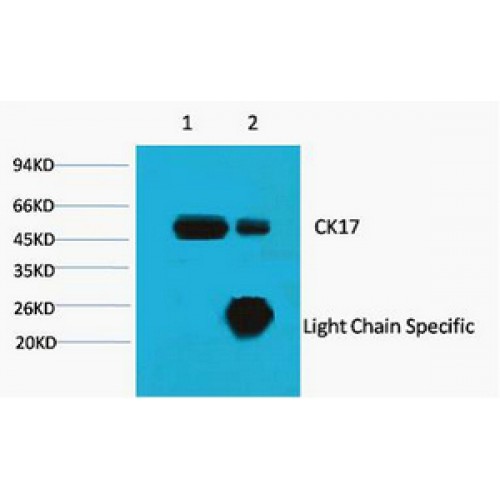 KRT17 / CK17 / Cytokeratin 17 Antibody - Immunoprecipitation of CK17 antibody