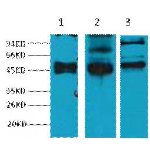 KRT17 / CK17 / Cytokeratin 17 Antibody - Western blot of CK17 antibody
