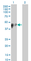 KRT17 / CK17 / Cytokeratin 17 Antibody - Western blot of KRT17 expression in transfected 293T cell line by KRT17 monoclonal antibody.
