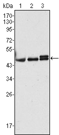 KRT17 / CK17 / Cytokeratin 17 Antibody - Western blot using CK17 mouse monoclonal antibody against HeLa (1), MCF-7 (2) and A431 (3) cell lysate.