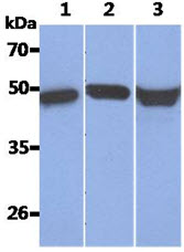 KRT17 / CK17 / Cytokeratin 17 Antibody - The Recombinant Human KRT17 (50ng) and Cell lysates (40ug) were resolved by SDS-PAGE, transferred to PVDF membrane and probed with anti-human KRT17 antibody (1:1000). Proteins were visualized using a goat anti-mouse secondary antibody conjugated to HRP and an ECL detection system. Lane 1.: Recombinant Human KRT17 Lane 2.: HeLa cell lysate Lane 3.: A431 cell lysate
