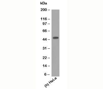 KRT17 / CK17 / Cytokeratin 17 Antibody - Cytokeratin 17 antibody E3 western blot.  This image was taken for the unmodified form of this product. Other forms have not been tested.