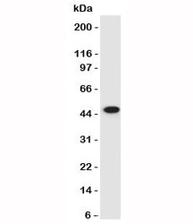 KRT17 / CK17 / Cytokeratin 17 Antibody - Western blot of HeLa lysate using CK17 antibody (SPM560).  This image was taken for the unmodified form of this product. Other forms have not been tested.