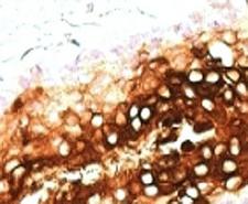 KRT17 / CK17 / Cytokeratin 17 Antibody - Formalin-fixed, paraffin-embedded human skin stained with CK17 antibody (SPM560).  This image was taken for the unmodified form of this product. Other forms have not been tested.