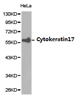 KRT17 / CK17 / Cytokeratin 17 Antibody - Western blot of extracts of HeLa cell lines, using Cytokeratin 17 antibody.