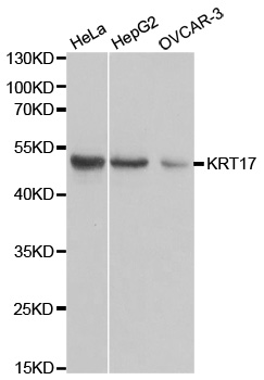 KRT17 / CK17 / Cytokeratin 17 Antibody - Western blot analysis of extracts of various cell lines.