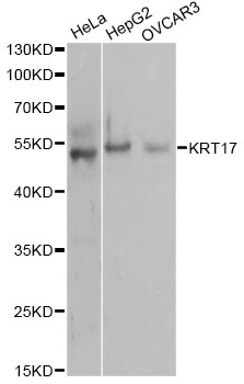 KRT17 / CK17 / Cytokeratin 17 Antibody - Western blot analysis of extracts of various cell lines, using KRT17 antibody at 1:1000 dilution. The secondary antibody used was an HRP Goat Anti-Rabbit IgG (H+L) at 1:10000 dilution. Lysates were loaded 25ug per lane and 3% nonfat dry milk in TBST was used for blocking.