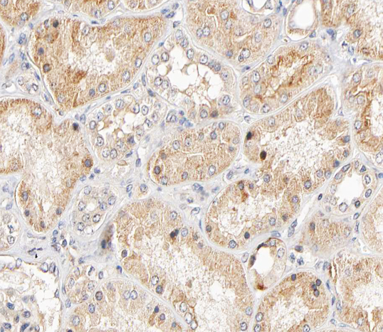 KRT17 / CK17 / Cytokeratin 17 Antibody - 1:200 staining human kidney tissue by IHC-P. The tissue was formaldehyde fixed and a heat mediated antigen retrieval step in citrate buffer was performed. The tissue was then blocked and incubated with the antibody for 1.5 hours at 22°C. An HRP conjugated goat anti-rabbit antibody was used as the secondary.