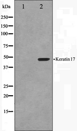 KRT17 / CK17 / Cytokeratin 17 Antibody - Western blot analysis on HuvEc cell lysates using Keratin 17 antibody. The lane on the left is treated with the antigen-specific peptide.