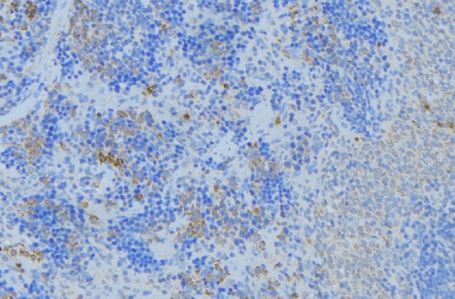 KRT17 / CK17 / Cytokeratin 17 Antibody - 1:100 staining human lymph node tissue by IHC-P. The sample was formaldehyde fixed and a heat mediated antigen retrieval step in citrate buffer was performed. The sample was then blocked and incubated with the antibody for 1.5 hours at 22°C. An HRP conjugated goat anti-rabbit antibody was used as the secondary.