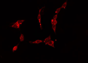 KRT17 / CK17 / Cytokeratin 17 Antibody - Staining HuvEc cells by IF/ICC. The samples were fixed with PFA and permeabilized in 0.1% Triton X-100, then blocked in 10% serum for 45 min at 25°C. The primary antibody was diluted at 1:200 and incubated with the sample for 1 hour at 37°C. An Alexa Fluor 594 conjugated goat anti-rabbit IgG (H+L) antibody, diluted at 1/600, was used as secondary antibody.