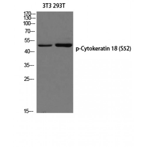 KRT18 / CK18 / Cytokeratin 18 Antibody - Western blot of Phospho-Cytokeratin 18 (S52) antibody
