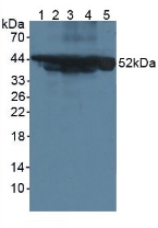 KRT18 / CK18 / Cytokeratin 18 Antibody - Western Blot; Sample: Lane1: Mouse Serum; Lane2: Mouse Intestine Tissue; Lane3: Mouse Pancreas Tissue; Lane4: Mouse Liver Tissue; Lane5: Human Hela Cells.