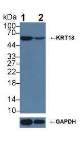 KRT18 / CK18 / Cytokeratin 18 Antibody - Knockout Varification: Lane 1: Wild-type Hela cell lysate; Lane 2: KRT18 knockout Hela cell lysate; Predicted MW: 48kDa ; Observed MW: 52kDa; Primary Ab: 1µg/ml Rabbit Anti-Mouse KRT18 Antibody; Second Ab: 0.2µg/mL HRP-Linked Caprine Anti-Rabbit IgG Polyclonal Antibody;