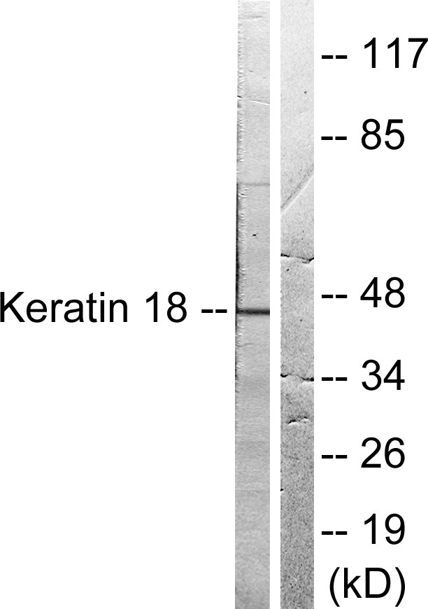 KRT18 / CK18 / Cytokeratin 18 Antibody - Western blot analysis of lysates from HeLa cells, treated with UV 5', using Keratin 18 Antibody. The lane on the right is blocked with the synthesized peptide.