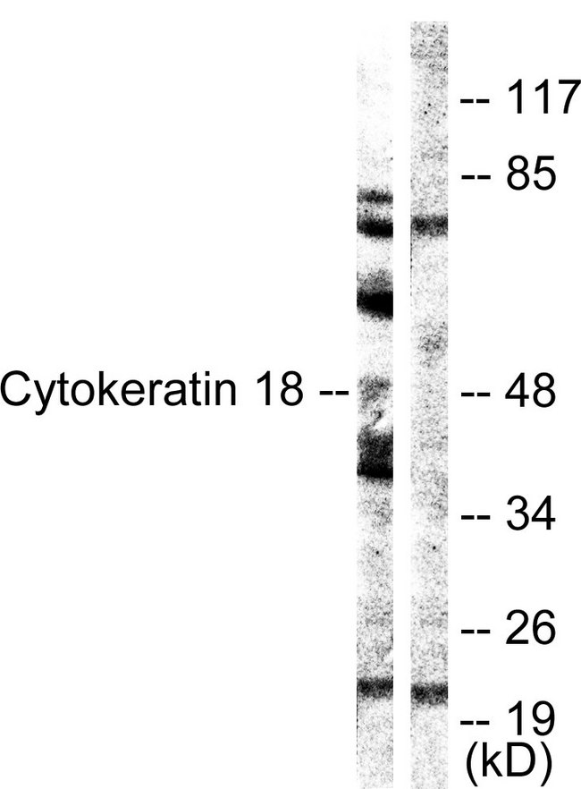 KRT18 / CK18 / Cytokeratin 18 Antibody - Western blot analysis of lysates from HUVEC cells, using Keratin 18 Antibody. The lane on the right is blocked with the synthesized peptide.
