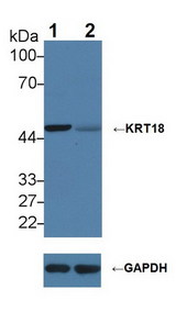 KRT18 / CK18 / Cytokeratin 18 Antibody - Knockout Varification: Lane 1: Wild-type Hela cell lysate; Lane 2: KRT18 knockout Hela cell lysate; Predicted MW: 48kDa Observed MW: 48kDa Primary Ab: 2µg/ml Rabbit Anti-Human KRT18 Antibody Second Ab: 0.2µg/mL HRP-Linked Caprine Anti-Rabbit IgG Polyclonal Antibody