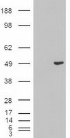 KRT18 / CK18 / Cytokeratin 18 Antibody - HEK293T cells were transfected with the pCMV6-ENTRY control (Left lane) or pCMV6-ENTRY KRT18 (Right lane) cDNA for 48 hrs and lysed. Equivalent amounts of cell lysates (5 ug per lane) were separated by SDS-PAGE and immunoblotted with anti-KRT18.