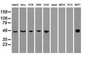 KRT18 / CK18 / Cytokeratin 18 Antibody - CK18 antibody (1E1) at 1:1000 dilution with HepG2 cell lysate.