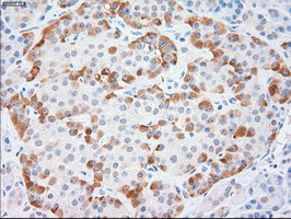 KRT18 / CK18 / Cytokeratin 18 Antibody - Anti-KRT18 mouse monoclonal antibody  immunofluorescent staining of COS7 cells transiently transfected by pCMV6-ENTRY KRT18.
