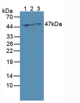 KRT18 / CK18 / Cytokeratin 18 Antibody - Western Blot; Sample: Lane1: Human MCF-7 Cells; Lane2: Human SGC7901 Cells; Lane3: Human Hela Cells.
