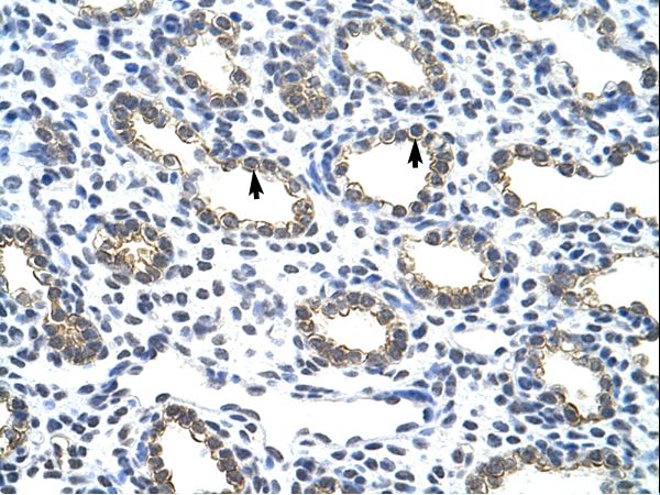KRT18 / CK18 / Cytokeratin 18 Antibody - KRT18 / Cytokeratin 18 antibody ARP40206_T100-NP_000215-KRT18 (keratin 18) Antibody was used in IHC to stain formalin-fixed, paraffin-embedded human lung.  This image was taken for the unconjugated form of this product. Other forms have not been tested.