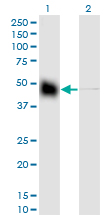 KRT18 / CK18 / Cytokeratin 18 Antibody - Western blot of KRT18 expression in transfected 293T cell line by KRT18 monoclonal antibody (M01), clone 2F8.