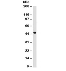 KRT18 / CK18 / Cytokeratin 18 Antibody - Western blot testing of HeLa cell lysate with CK18 antibody (clone B23.1). This image was taken for the unmodified form of this product. Other forms have not been tested.