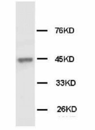 KRT18 / CK18 / Cytokeratin 18 Antibody -  This image was taken for the unconjugated form of this product. Other forms have not been tested.