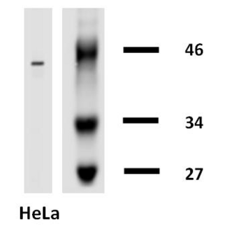 KRT18 / CK18 / Cytokeratin 18 Antibody - Western Blotting analysis of cytokeratin 18 in HeLa cells using anti-cytokeratin 18 (clone DA-7) biotin.