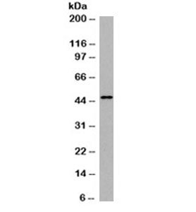 KRT18 / CK18 / Cytokeratin 18 Antibody - Western blot testing of HeLa cell lysate with Cytokerain 18 antibody (clone DE-K18). Expected molecular weight: 46-50kDa.