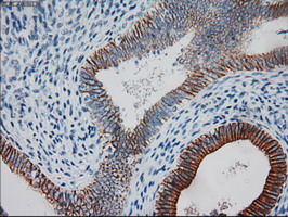 KRT18 / CK18 / Cytokeratin 18 Antibody - Anti-KRT18 mouse monoclonal antibody  immunofluorescent staining of COS7 cells transiently transfected by pCMV6-ENTRY KRT18.