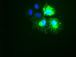 KRT18 / CK18 / Cytokeratin 18 Antibody - Anti-KRT18 mouse monoclonal antibody immunofluorescent staining of COS7 cells transiently transfected by pCMV6-ENTRY KRT18.