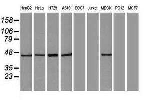 KRT18 / CK18 / Cytokeratin 18 Antibody - CK18 antibody (5E8) at 1:2000 dilution with HepG2 cell lysate.
