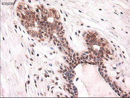 KRT18 / CK18 / Cytokeratin 18 Antibody - IHC of paraffin-embedded breast using anti-KRT18 mouse monoclonal antibody.