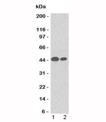 KRT18 / CK18 / Cytokeratin 18 Antibody - Western blot testing of 1) A431 and 2) HeLa lysate using Cytokeratin 18 antibody (SPM265).  This image was taken for the unmodified form of this product. Other forms have not been tested.