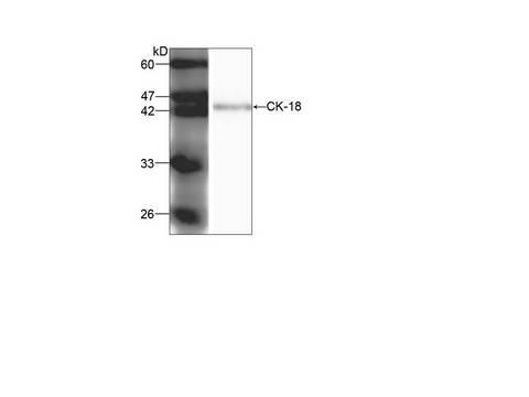 KRT18 / CK18 / Cytokeratin 18 Antibody