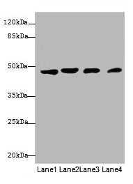 KRT18 / CK18 / Cytokeratin 18 Antibody - Western blot All lanes: KRT18 antibody at 12µg/ml Lane 1: A431 whole cell lysate Lane 2: Hela whole cell lysate Lane 3: Jurkat whole cell lysate Lane 4: Zebrafish lysate Secondary Goat polyclonal to rabbit IgG at 1/10000 dilution Predicted band size: 49 kDa Observed band size: 49 kDa