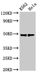 KRT18 / CK18 / Cytokeratin 18 Antibody - Western Blot Positive WB detected in: K562 whole cell lysate, Hela whole cell lysate All lanes: KRT18 antibody at 3µg/ml Secondary Goat polyclonal to rabbit IgG at 1/50000 dilution Predicted band size: 49 kDa Observed band size: 49 kDa