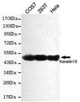 KRT18 / CK18 / Cytokeratin 18 Antibody - Western blot detection of Keratin 18 in HeLa, COS7 and 293T cell lysates using Keratin 18 mouse monoclonal antibody (1:2000 dilution). Predicted band size: 46KDa. Observed band size:46KDa.