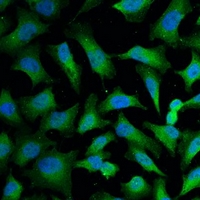 KRT18 / CK18 / Cytokeratin 18 Antibody - Immunofluorescent analysis of Cytokeratin 18 staining in HeLa cells. Formalin-fixed cells were permeabilized with 0.1% Triton X-100 in TBS for 5-10 minutes and blocked with 3% BSA-PBS for 30 minutes at room temperature. Cells were probed with the primary antibody in 3% BSA-PBS and incubated overnight at 4 deg C in a humidified chamber. Cells were washed with PBST and incubated with a FITC-conjugated secondary antibody (green) in PBS at room temperature in the dark. DAPI was used to stain the cell nuclei (blue).