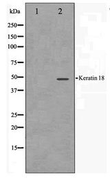 KRT18 / CK18 / Cytokeratin 18 Antibody - Western blot of HT29 cell lysate using Keratin 18 Antibody