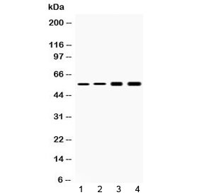 KRT18 / CK18 / Cytokeratin 18 Antibody - Western blot testing of 1) rat liver, 2) mouse liver, 3) human HeLa and 4) human HepG2 lysate with Cytokeratin 18 antibody at 0.5ug/ml. Predicted molecular weight ~48 kDa.